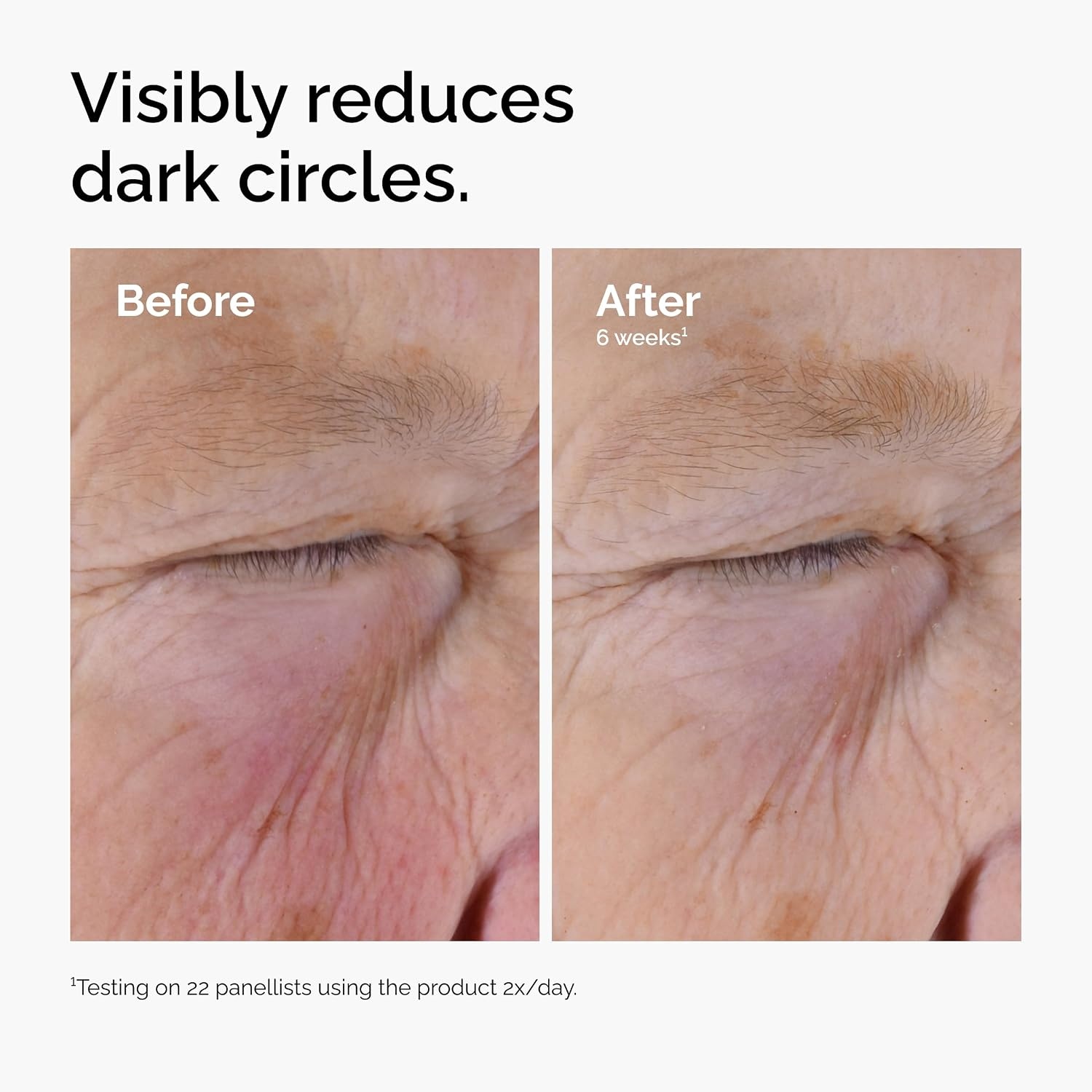image:imageThe Ordinary Caffeine Solution 5 EGCG Eye Serum Depuffing Eye Serum for Dark Circles and Tired Eyes1 Fl Oz Pack of 2