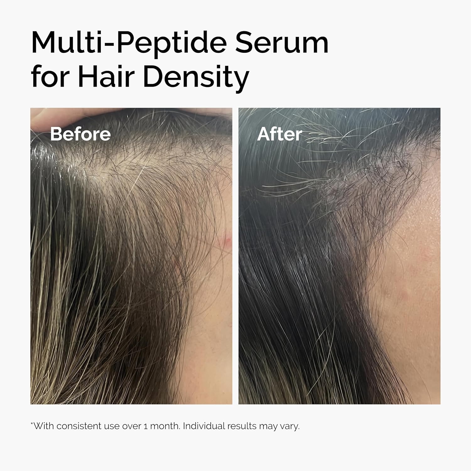 image:imageThe Ordinary MultiPeptide Serum for Hair Density PeptidePowered Formula for Thicker Fuller Looking Hair202 Count Pack of 1