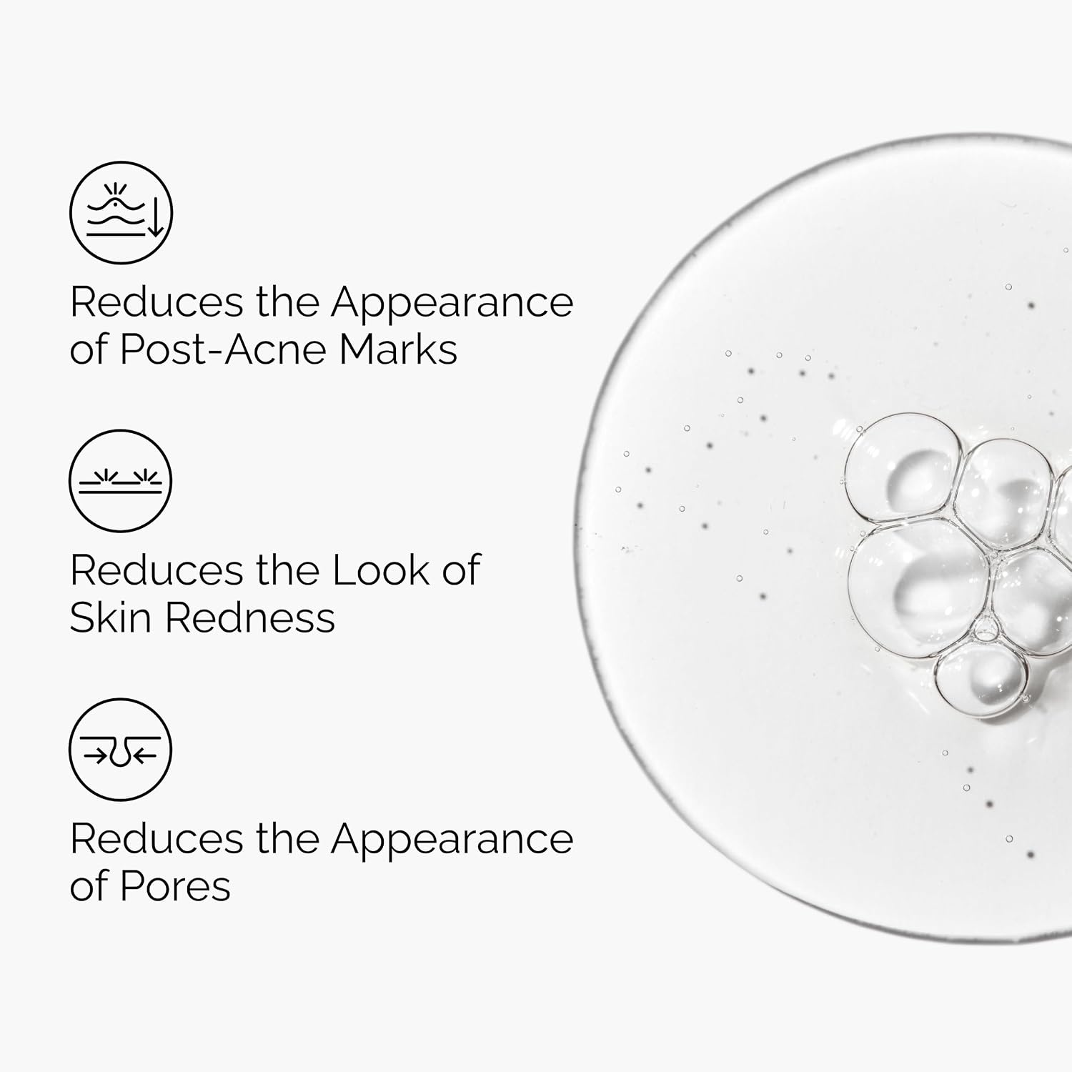 image:imageThe Ordinary Aloe 2 NAG 2 Solution Soothes Skin and Targets PostAcne Marks 1 Fl Oz