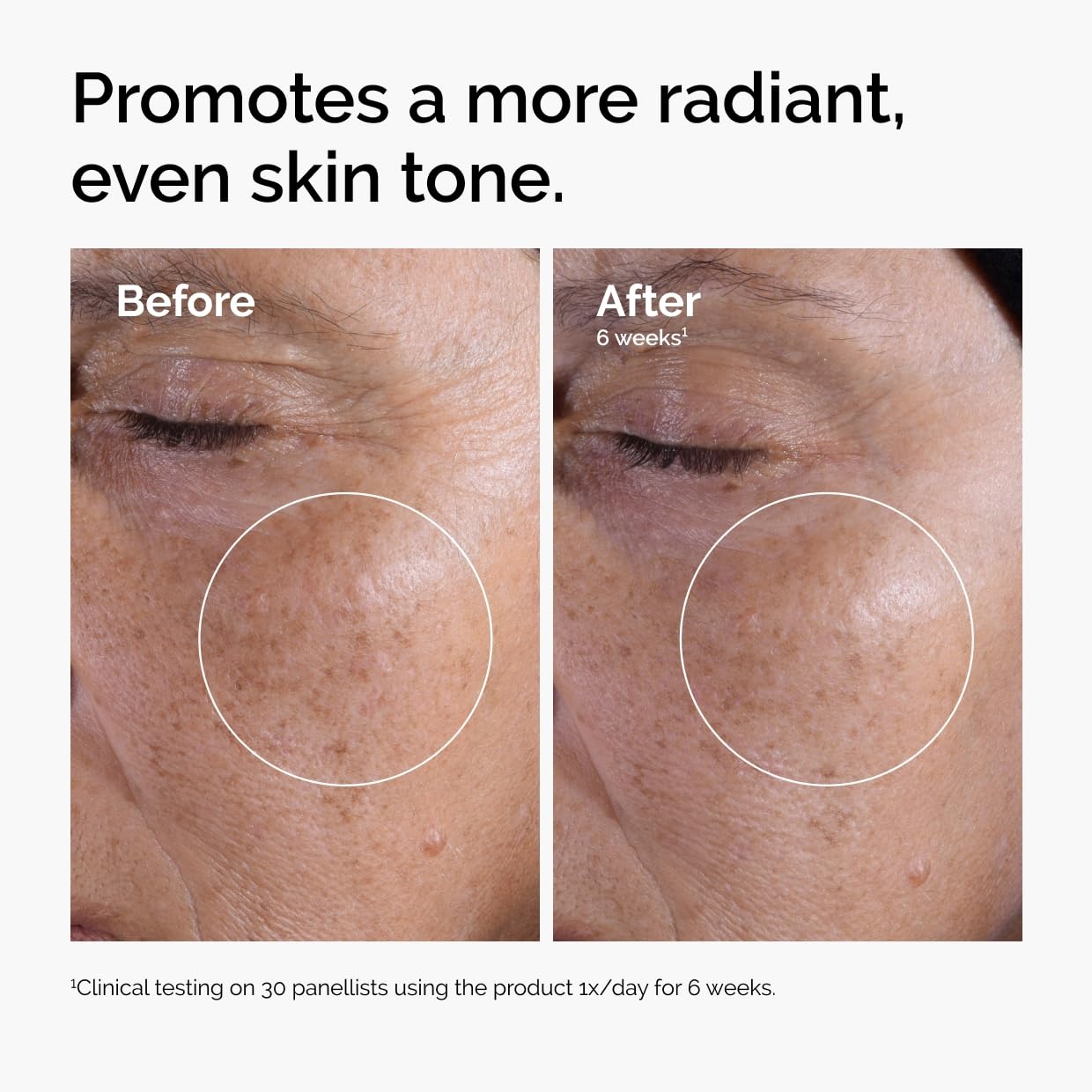 image:imageThe Ordinary The Mini Icons Set Travel Size Skin Care to Hydrate and Brighten Glycolic Acid 7 Exfoliating Toner Niacinamide 10 Zinc 1 Hyaluronic Acid 2 B5 4 Reusable Rounds