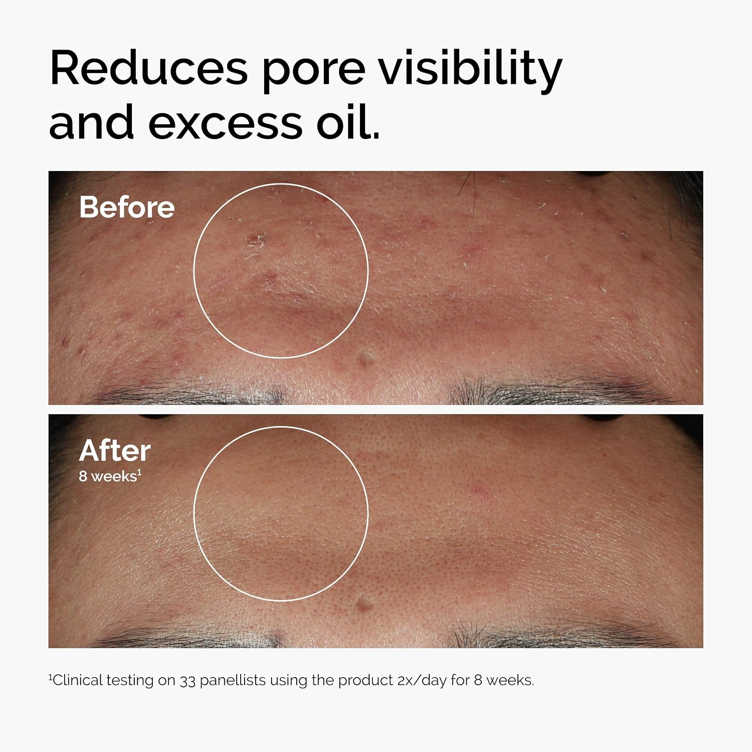 image:imageThe Ordinary Serum Favorites Set Hyaluronic Acid 2 B5 Niacinamide 10 Zinc 1 Caffeine Solution 5 EGCG Eye Serum Serums for Hydrating Brightening amp PoreMinimizing Skin Care