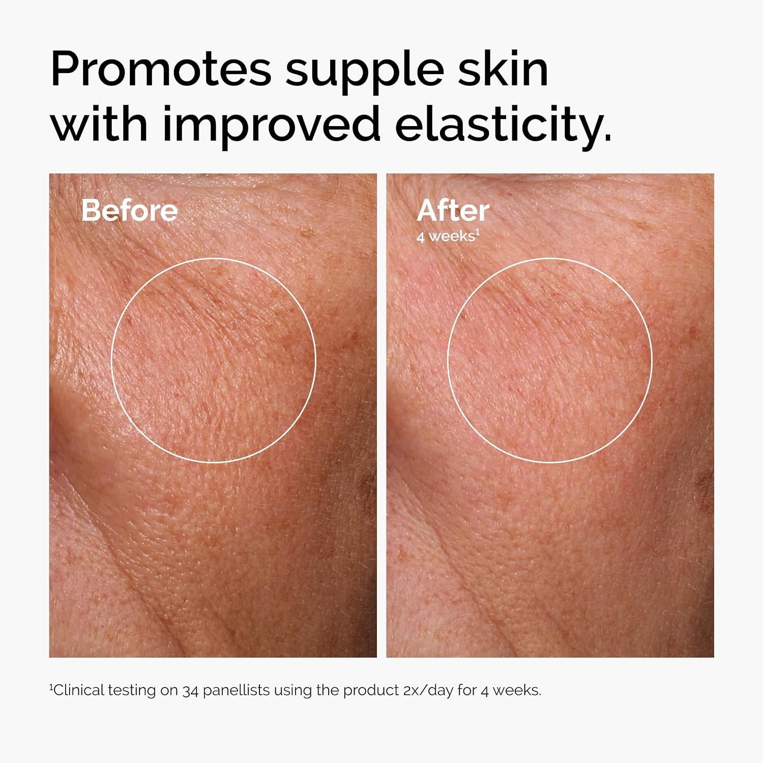 image:imageThe Ordinary Serum Favorites Set Hyaluronic Acid 2 B5 Niacinamide 10 Zinc 1 Caffeine Solution 5 EGCG Eye Serum Serums for Hydrating Brightening amp PoreMinimizing Skin Care